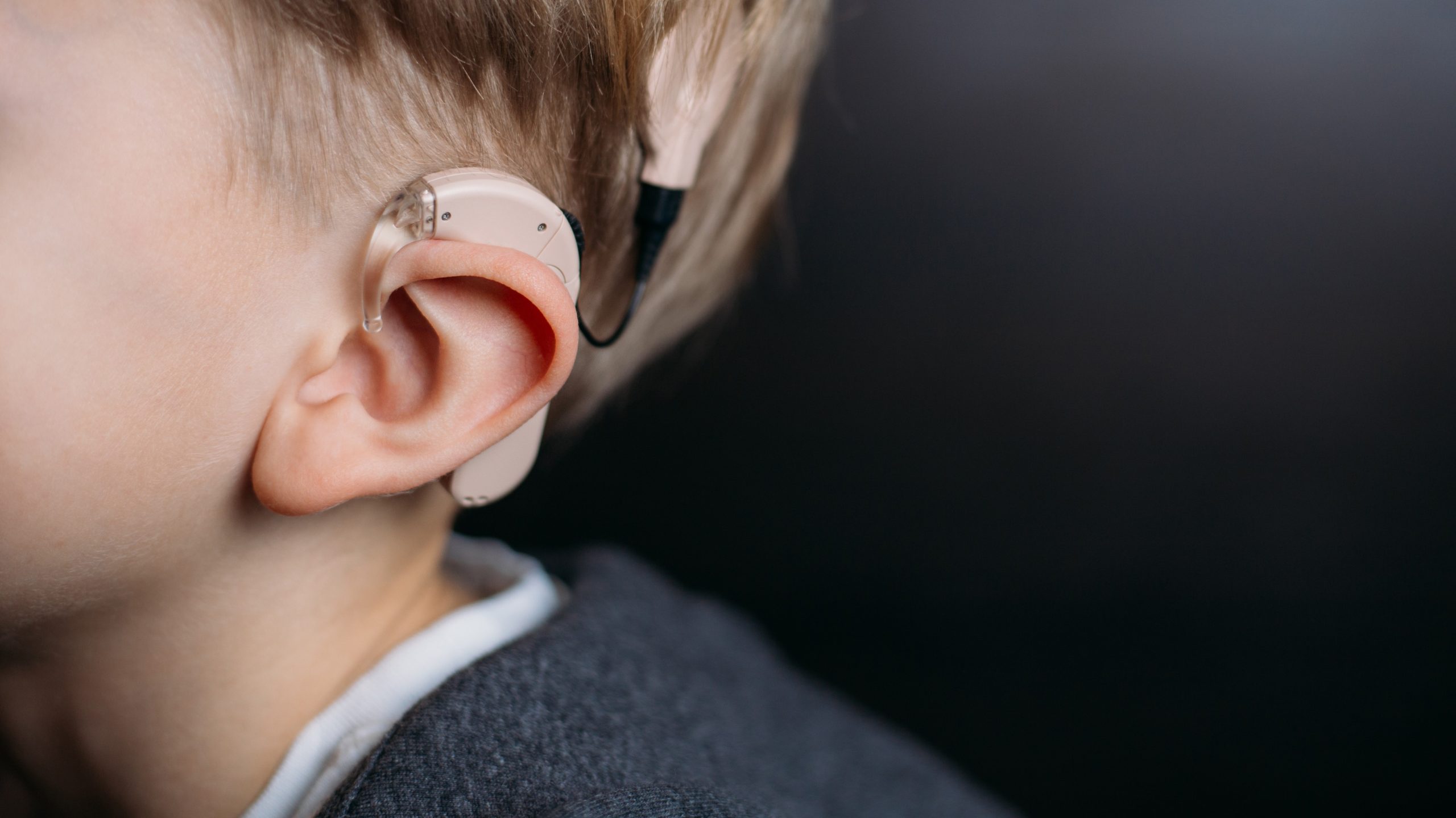 Cochlear Implant 1 61fb3abd1e66440679a41461 5356 thumbnail scaled - Cochlear Implant - Cochlear Implant Surgery