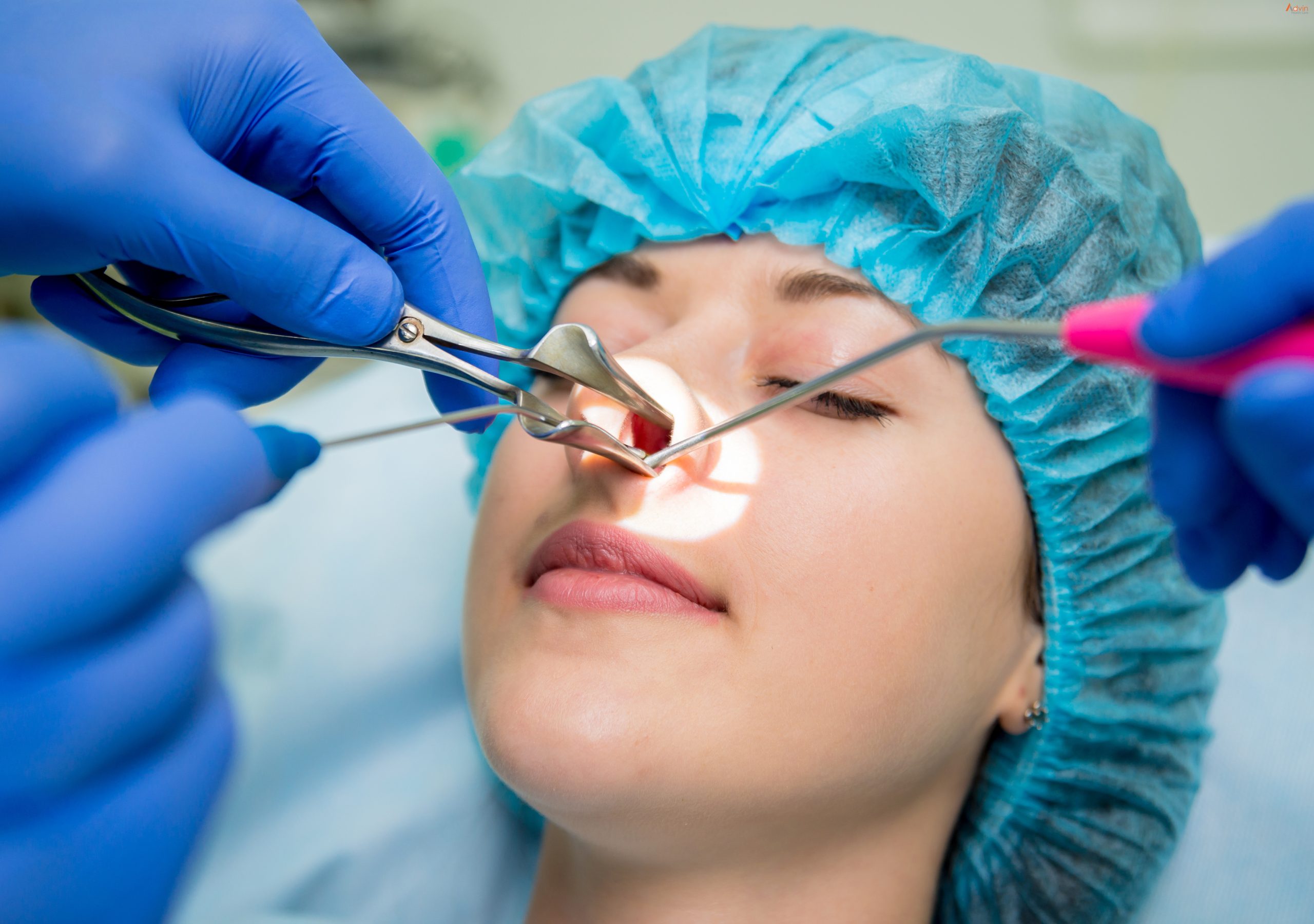 Functional Endoscopic Sinus Surgery 1 scaled - Endoscopic Of Nose - Endoscopic Of Nose Surgery