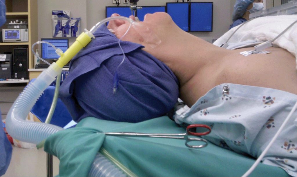 Blog Image 1 01 - Microlaryngoscopy: Procedure Details and Recovery -
