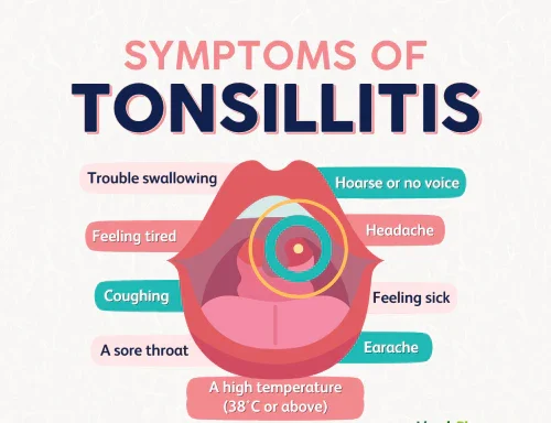 Tonsillitis Treatment in Indore 1 INFO FB Tonsillitis Symptoms e1744183406937 - Tonsillitis Treatment in Indore - Nose Specialist