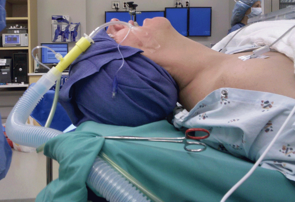 Microlaryngoscopy: Procedure Details and Recovery