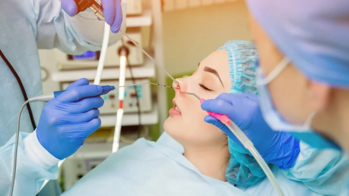 Endoscopic Surgery vs Traditional: Which Is Better for Nasal Disorders?