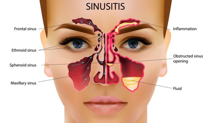 sinus-image sinus-image